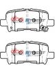 DBA SS Street Series Brake Pads