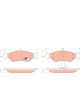 TRW Brake Pads