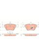 TRW Brake Pads