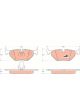 TRW Brake Pads