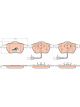 TRW Brake Pads