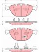 TRW Brake Pads