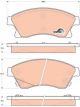 TRW DTEC Brake Pads