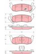 TRW Brake Pads