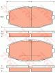TRW Brake Pads