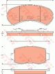 TRW Brake Pads