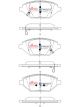 DBA Street Series Brake Pads