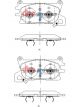 DBA Street Series Brake Pads