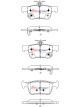 DBA Street Series Brake Pads