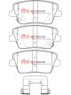 DBA Xtreme Performance Brake Pads