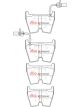 DBA Xtreme Performance Brake Pads