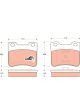 TRW Brake Pads