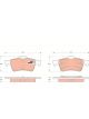 TRW Brake Pads