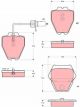 TRW Brake Pads