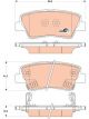 TRW DTEC Brake Pads