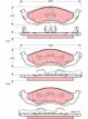 TRW Brake Pads