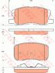 TRW Brake Pads