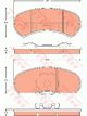 TRW Brake Pads