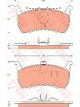 TRW Brake Pads