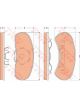 TRW Brake Pads