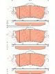 TRW DTEC Brake Pads