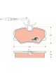 TRW Brake Pads
