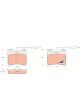 TRW Brake Pads
