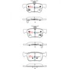 DBA Street Series Brake Pads